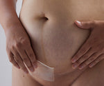 Load image into Gallery viewer, Silicone Gel Scar Strips