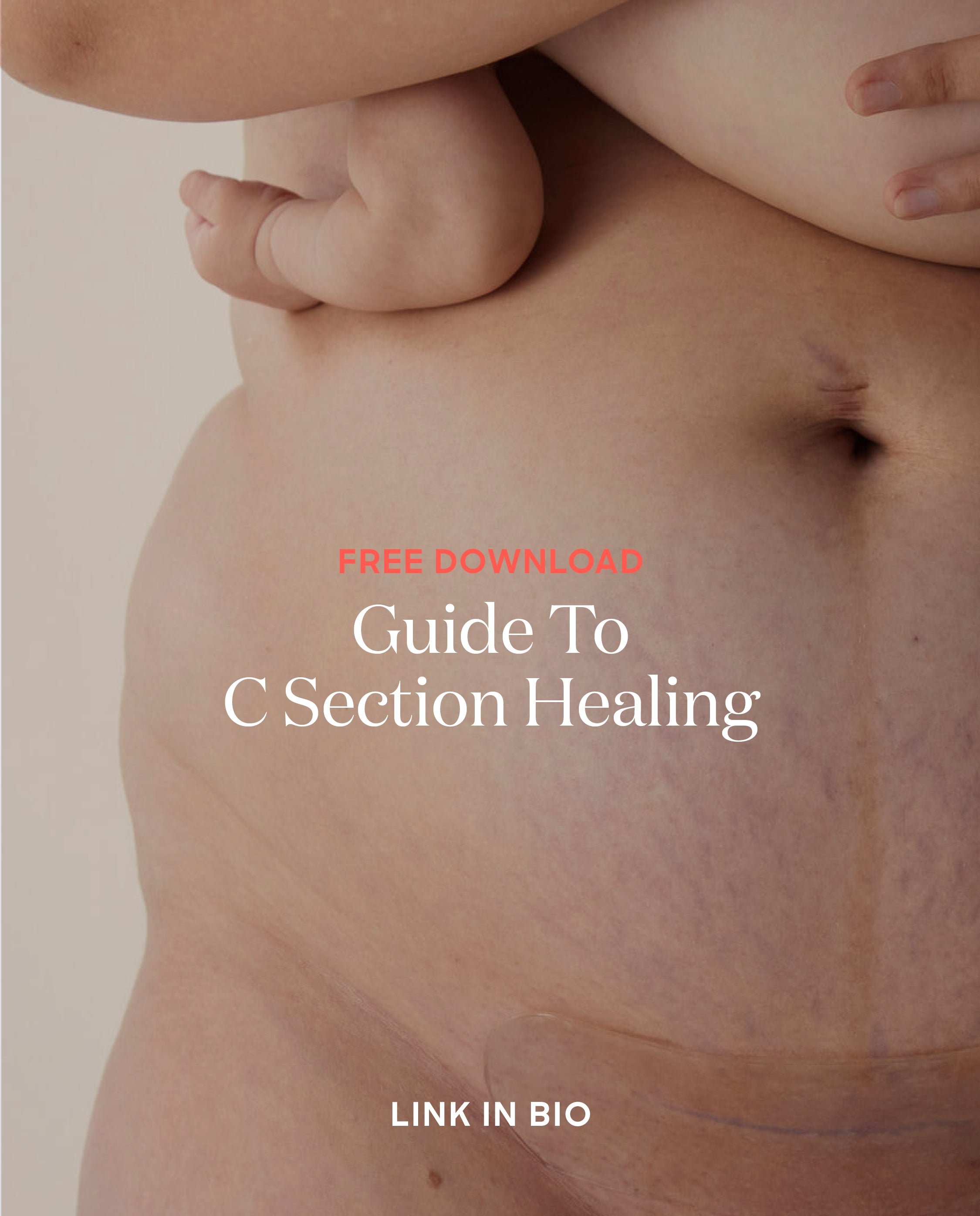 Your Free Guide to Recovery Post C Section